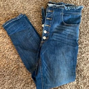 Express Skinny Jeans
